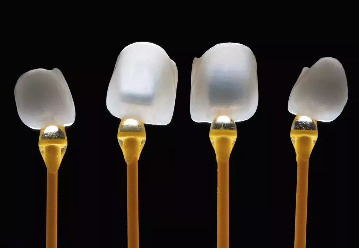 Veneers